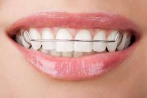 soluciones para falta de piezas dentales